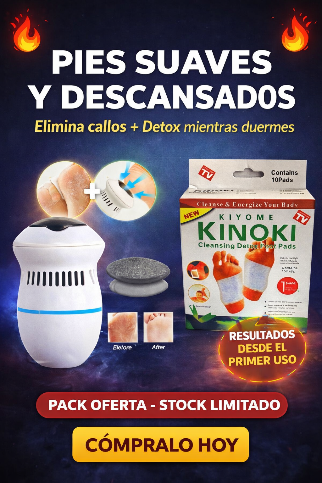 Pack Quitacallos + Kinoki